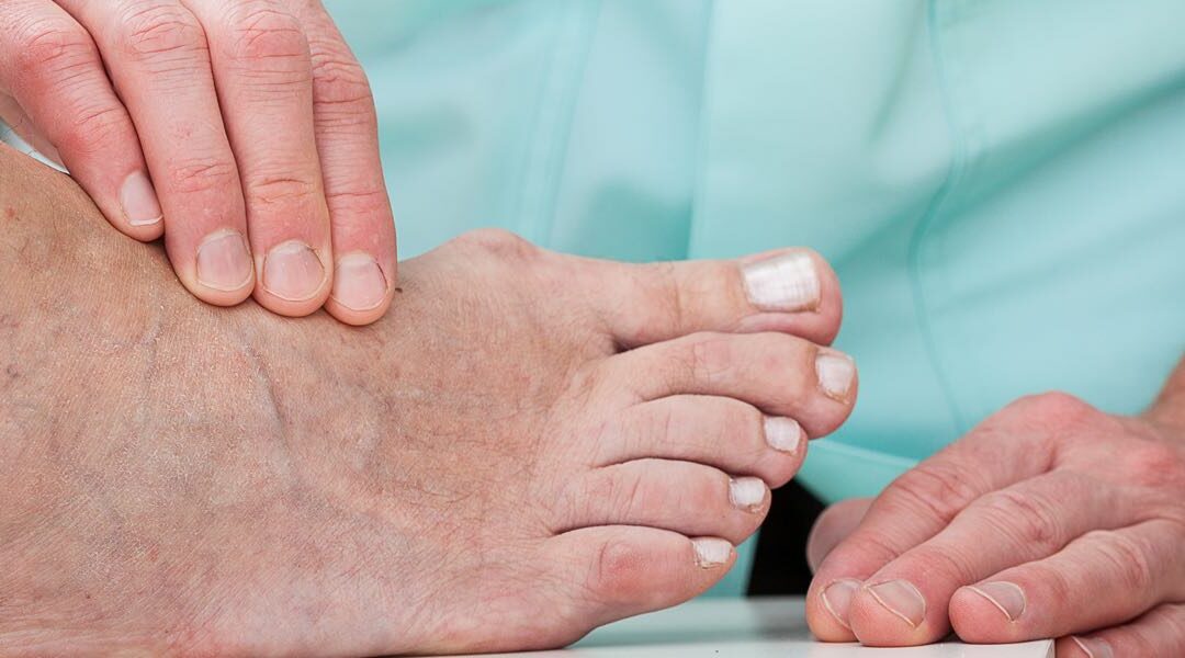 Reumatische voetklachten: wat kunnen wij doen?